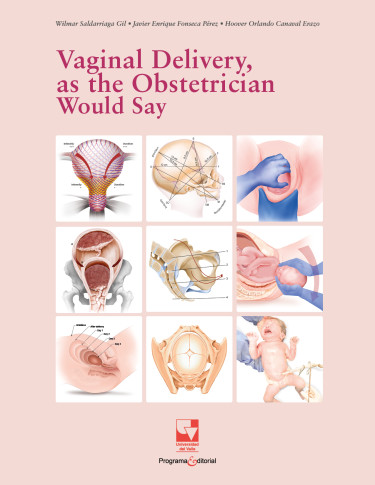 Vaginal Delivery, as the Obstetrician Would Say