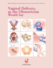 Portada de la publicación Vaginal Delivery, as the Obstetrician Would Say