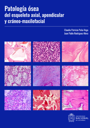 Patología ósea del esqueleto axial, apendicular y cráneo-maxilofacial