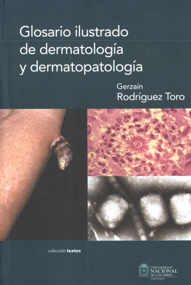 Glosario ilustrado de dermatología y dermatopatología