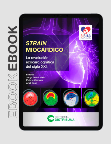 Strain Miocárdico