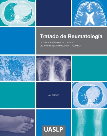 Tratado de Reumatología