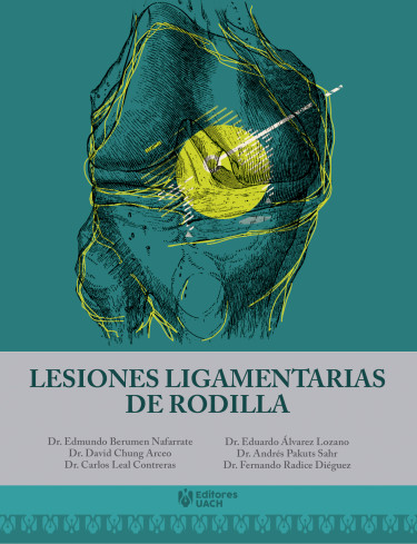 Lesiones ligamentarias de rodilla