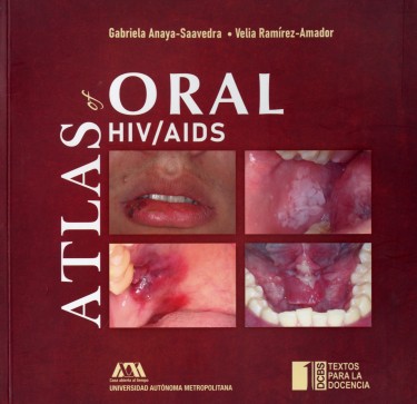 Atlas of oral HIV/AIDS