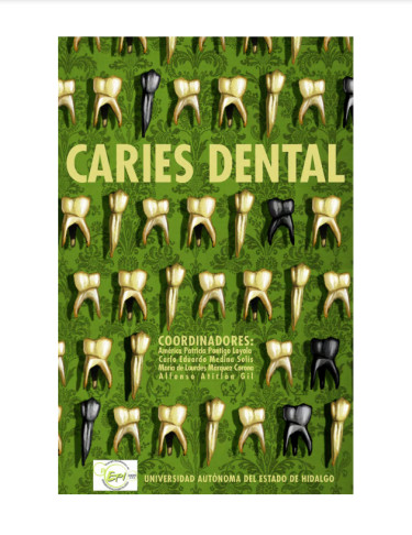 CARIES DENTAL