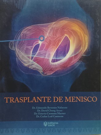 Trasplante de menisco