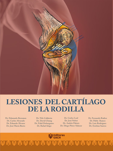 Lesiones del cartílago de la rodilla